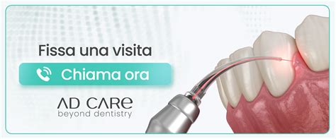 Cura Parodontite A Milano Centro Studio Dentistico Ad Care Milano