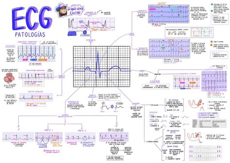 Electrocardiograma Arritmias Mega Esquema Cardiolog A The Best Porn