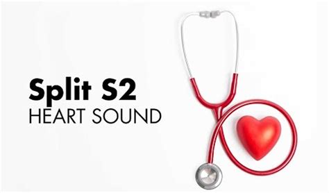 Split S2 heart sound, causes of split S2 & abnormal split S2 heart sound