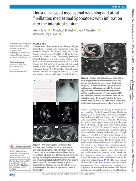 Pdf Unusual Cause Of Mediastinal Widening And Atrial Fibrillation Mediastinal Lipomatosis