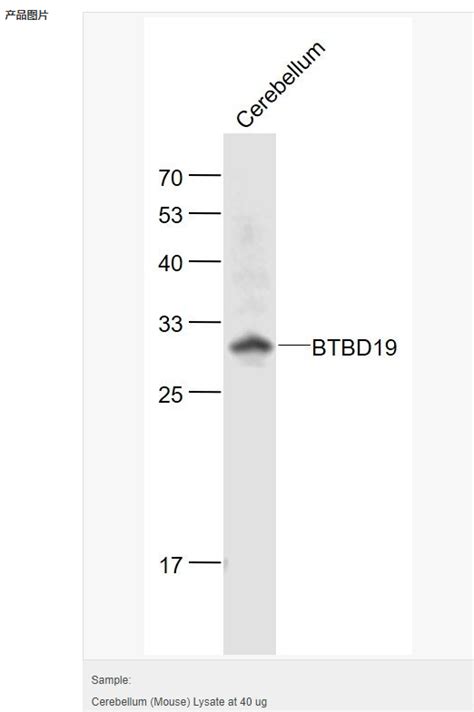 Btbpoz结构域蛋白19抗体 北京拜尔迪生物技术有限公司