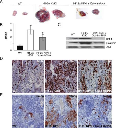 HIF 2 Mediates Tumor Growth Through Up Regulation Of Oct 4 A Gross