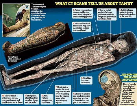 Scan Reveals Spatula Left Lodged Inside Skull Of Ancient Mummy Daily