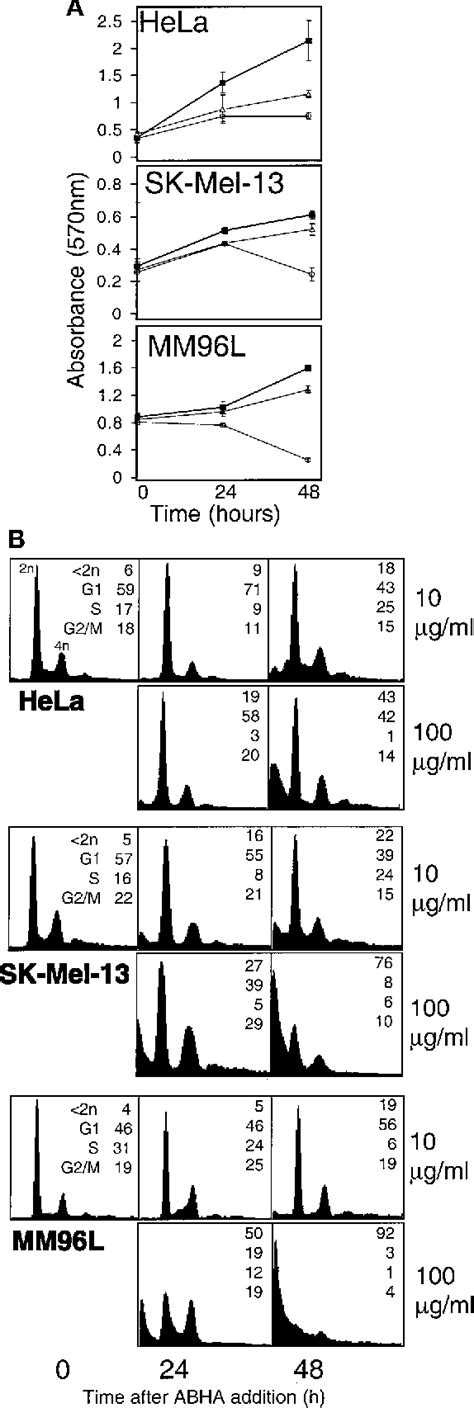 Figure 1 From Up Regulation Of P21waf1cip1 By Histone Deacetylase