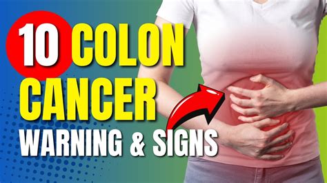 Colon Cancer Symptoms 10 Signs And Symptoms Of Colon Cancer Youtube