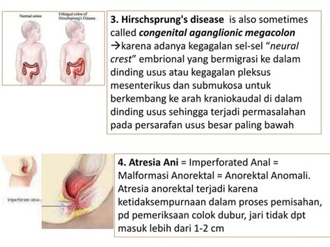 Kelainan Kongenital Pptx Ppt