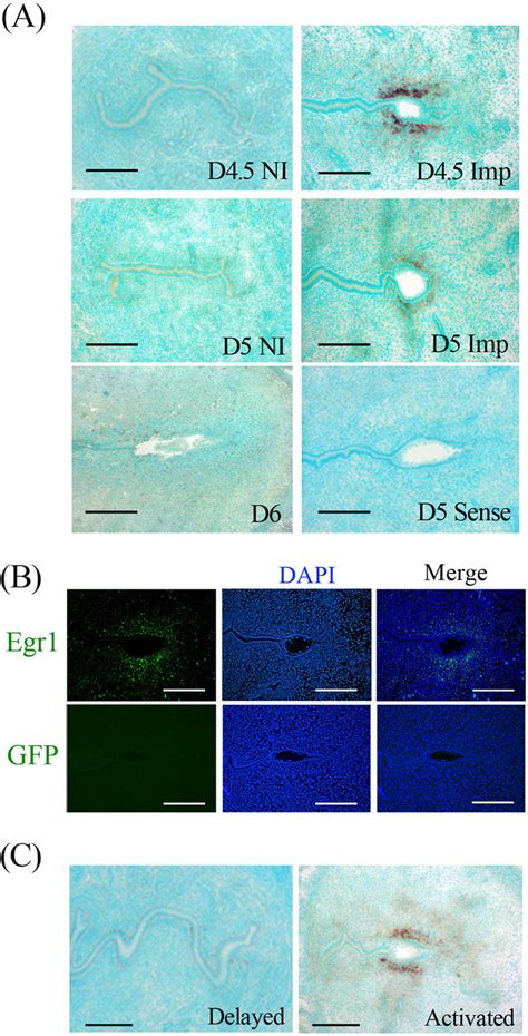 Spatiotemporal Expressions Of Egr Mrna And Protein In Mouse Uterus