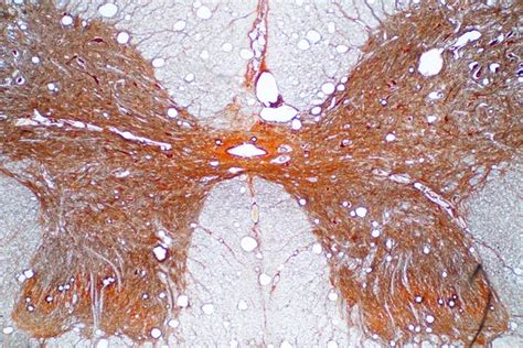 Secci N Transversal De La M Dula Espinal Bajo El Microscopio Histol