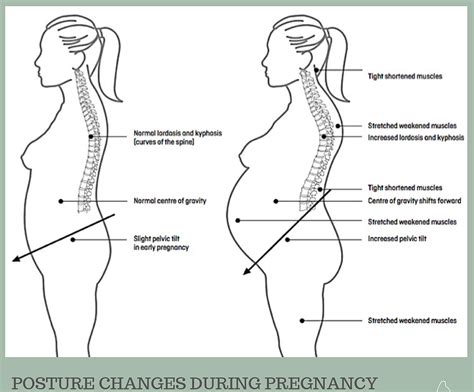 Understanding Back Pain In Pregnancy Wild Kat Yoga