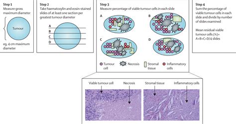 Pathological Response After Neoadjuvant Chemotherapy In Resectable Non