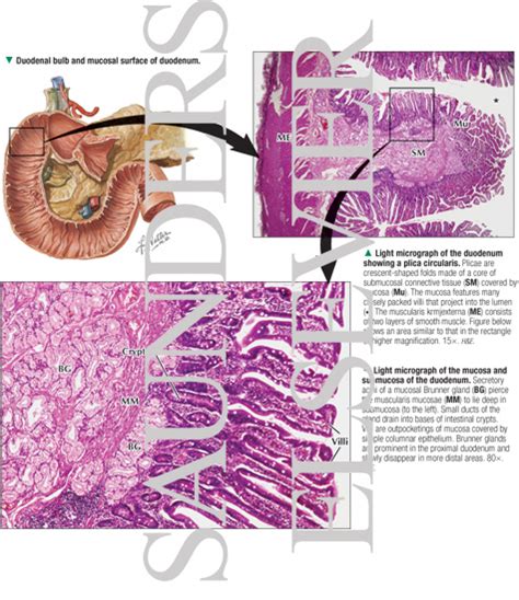 Duodenal Bulb And Mucosal Surface Of Duodenum With Light Micrograph Of