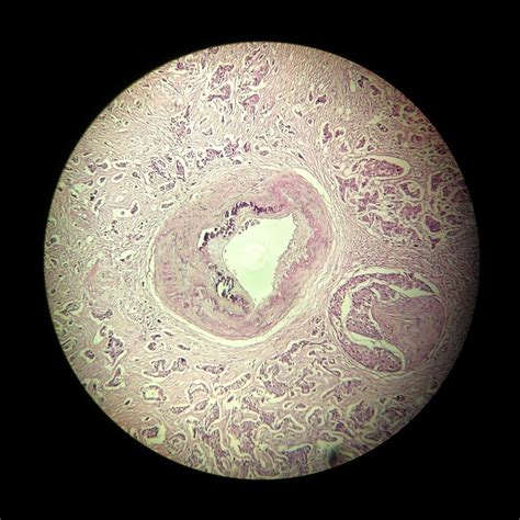 pathology pathologyoutlines pathologyoutlinescom