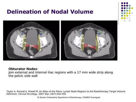 Imrt And 3d Crt In Cervical Cancers Ppt