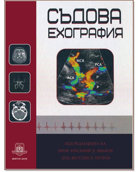Съдова ехография - книга - store.bg