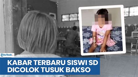 Kabar Terbaru Soal Siswi Sd Buta Dicolok Tusuk Bakso Di Gresik Jawa