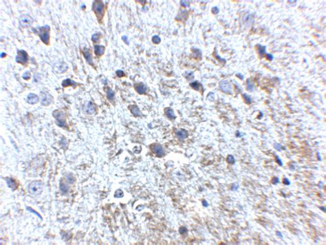 Amyloid Precursor Protein Polyclonal Antibody Pa5 20711