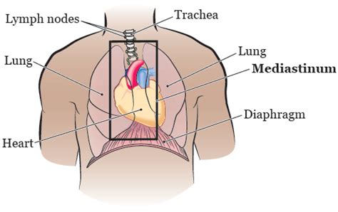 About Your Mediastinoscopy Memorial Sloan Kettering Cancer Center