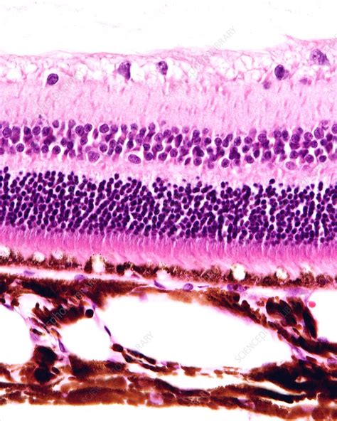 Retina And Choroid Light Micrograph Stock Image C