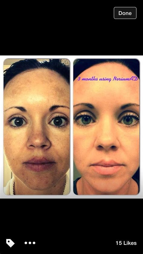 Not Just For Aging Skin All Skin Nerium Results Amandaeller