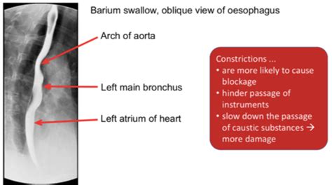 B1 Foregut Flashcards Quizlet