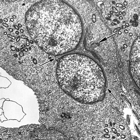 Transmission Electron Micrographs Of Testicular Sections From A 61 Week