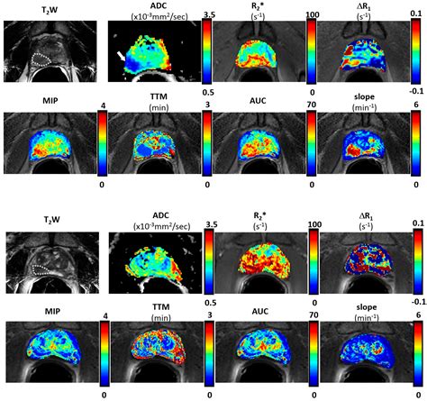 Diagnostics Free Full Text Incorporating Oxygen Enhanced MRI Into