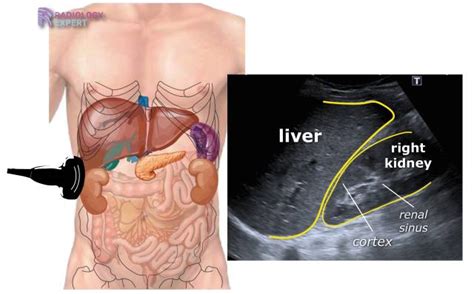 Abdominal ultrasound