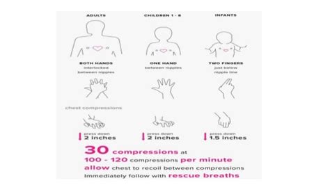 Cardiac Arrest Cpr Shock