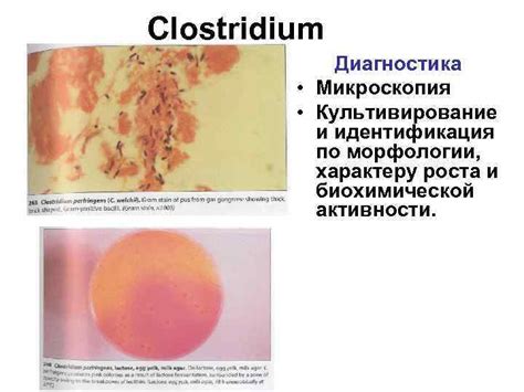 Анаэробы Clostridium Клостридии Грам