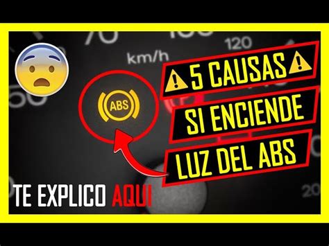 Descubre Qu Significa Abs En El Coche Todo Lo Que Necesitas Saber