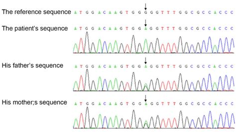 A Homozygous Missense Mutation In Exon Of The Tyk Gene In Our