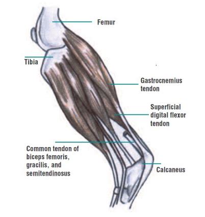 Tendon Diagram - Finger Flexor Tendon Anatomy Britannica - amlanguage-wall