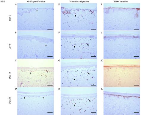 Proliferation, migration and invasion of skin cells. (A)-(D ... 