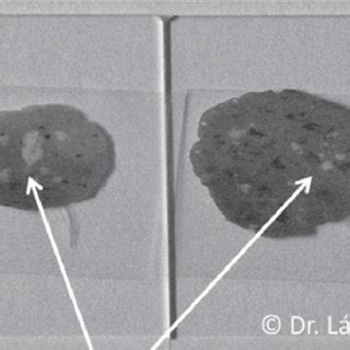 Small pieces of stool covered with white mucus | Download Scientific ...