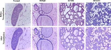 Breast Cancer Histology Image Classification Models Code And Papers