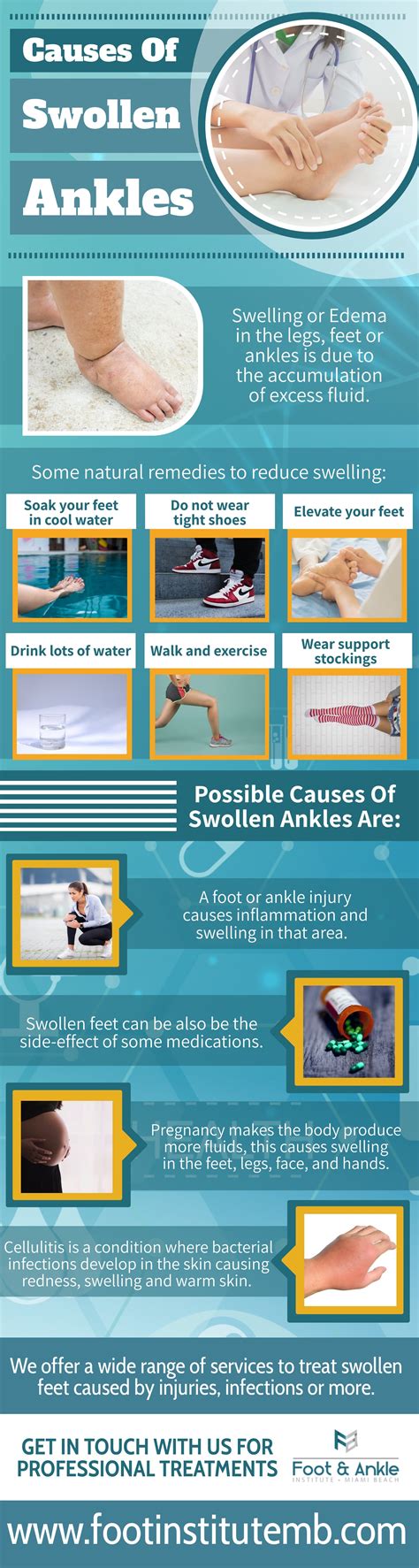 Causes Of Swollen Ankles