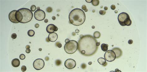 We grew human tear glands in the lab, and now we're making them cry