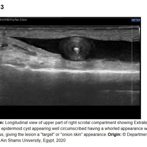 Annotated Version Of Figure 2 Left Hemiscrotum Transverse Plane At Download Scientific