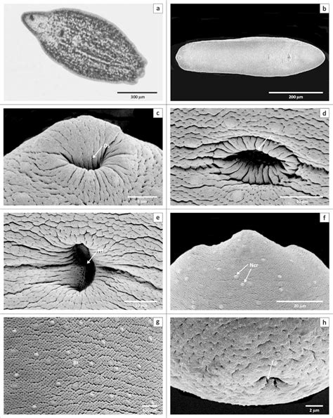 Light And Scanning Electron Micrographs A Light Micrograph B