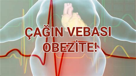 Çağın Vebası Obezite Tedavisi ve Cerrahisi YouTube