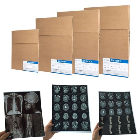 Lyd Factoy Price Fuji Film Medical X Ray Inkjet Blue Dry X Ray Films