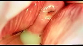 Insertion Semen Cum In Cervix Wide Stretching Pussy Speculum XNXX