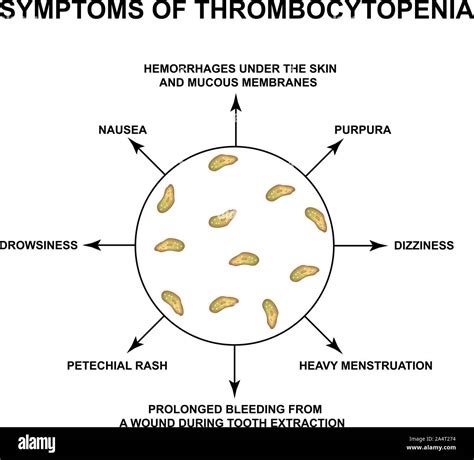 Symptoms of thrombocytopenia. Reducing platelets in the blood ...