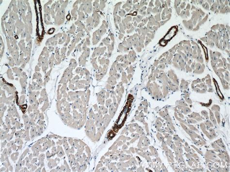 Alpha Smooth Muscle Actin Antibody 14395 1 Ap Proteintech