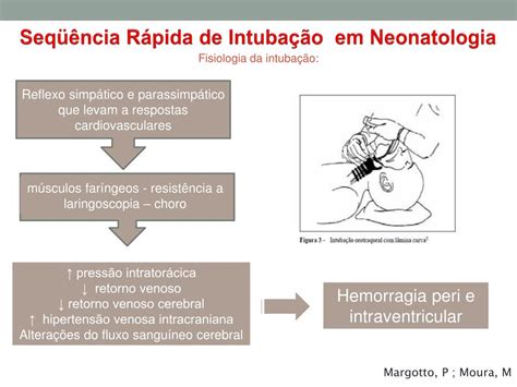 Ppt Intuba O E Sequ Ncia R Pida Powerpoint Presentation Free