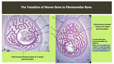 Osteogenesis 3 Development of a Long Bone - YouTube