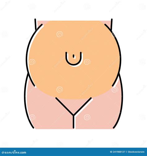 Umbilical Hernia. Cross Section Of Abdomen With Small Intestine Vector