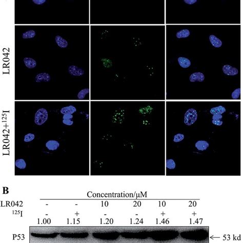 A Lr042 Enhanced The 125 I Induced Dna Damage Of The Hepg2 Cells The