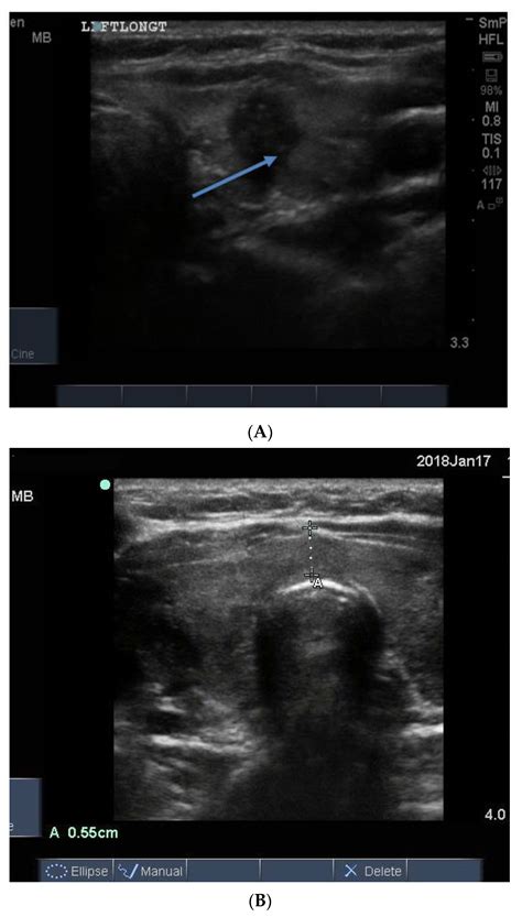 Reports Free Full Text Ultrasonographic Findings In Common Thyroid