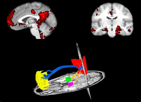 Resting State Connectivity Pnas